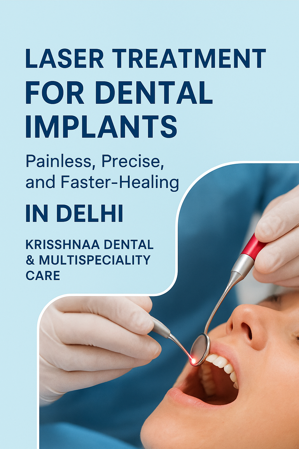 Laser Treatment for Dental Implants in Delhi